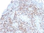 ZAP70 Antibody in Immunohistochemistry (Paraffin) (IHC (P))