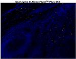 Granzyme B Antibody in Immunohistochemistry (Paraffin) (IHC (P))