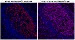 Ki-67 Antibody in Immunohistochemistry (Paraffin) (IHC (P))