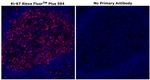 Ki-67 Antibody in Immunohistochemistry (Paraffin) (IHC (P))