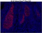 Ki-67 Antibody in Immunohistochemistry (Paraffin) (IHC (P))