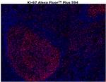 Ki-67 Antibody in Immunohistochemistry (Paraffin) (IHC (P))