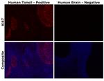 Ki-67 Antibody in Immunohistochemistry (Paraffin) (IHC (P))