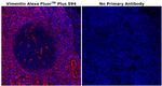 Vimentin Antibody in Immunohistochemistry (Paraffin) (IHC (P))