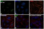 Ki-67 Antibody