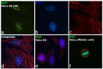 Ki-67 Antibody