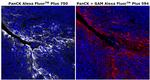 Pan Cytokeratin Antibody in Immunohistochemistry (Paraffin) (IHC (P))