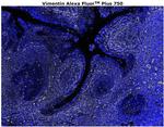 Vimentin Antibody in Immunohistochemistry (Paraffin) (IHC (P))