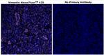 Vimentin Antibody in Immunohistochemistry (Paraffin) (IHC (P))