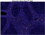 Vimentin Antibody in Immunohistochemistry (Paraffin) (IHC (P))