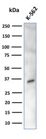 Carbonic Anhydrase VIII Antibody in Western Blot (WB)