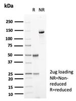 Carbonic Anhydrase VIII Antibody in SDS-PAGE (SDS-PAGE)