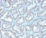 Renal Cell Carcinoma (Carbonic Anhydrase IX) Antibody in Immunohistochemistry (Paraffin) (IHC (P))