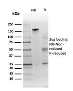 Renal Cell Carcinoma (Carbonic Anhydrase IX) Antibody in SDS-PAGE (SDS-PAGE)