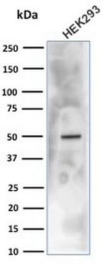 Renal Cell Carcinoma (Carbonic Anhydrase IX) Antibody in Western Blot (WB)