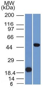 PAX8 Antibody in Western Blot (WB)