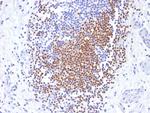 PAX8 (Renal Cell Marker) Antibody in Immunohistochemistry (Paraffin) (IHC (P))