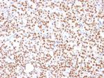 PAX8 (Renal Cell Marker) Antibody in Immunohistochemistry (Paraffin) (IHC (P))