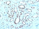 PAX8 (Renal Cell Marker) Antibody in Immunohistochemistry (Paraffin) (IHC (P))