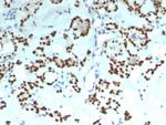 PAX8 Antibody in Immunohistochemistry (Paraffin) (IHC (P))