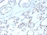 PAX8 (Renal Cell Marker) Antibody in Immunohistochemistry (Paraffin) (IHC (P))