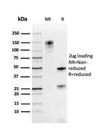 PAX8 (Renal Cell Marker) Antibody in SDS-PAGE (SDS-PAGE)