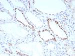 PAX8 (Renal Cell Marker) Antibody in Immunohistochemistry (Paraffin) (IHC (P))