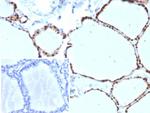 PAX8 (Renal Cell Marker) Antibody in Immunohistochemistry (Paraffin) (IHC (P))