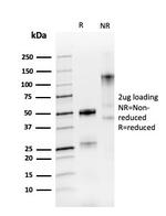 PAX8 (Renal Cell Marker) Antibody in SDS-PAGE (SDS-PAGE)