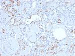 PAX8 (Renal Cell Marker) Antibody in Immunohistochemistry (Paraffin) (IHC (P))