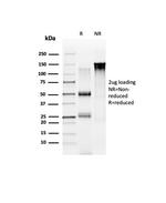 Nucleolar complex-associated protein 4-like protein (NOC4L) Antibody in SDS-PAGE (SDS-PAGE)