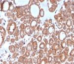 Calcitonin Antibody in Immunohistochemistry (Paraffin) (IHC (P))