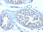 B7-H4 (Immuno-Inhibitory Protein) Antibody in Immunohistochemistry (Paraffin) (IHC (P))