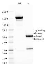 B7-H4 (Immuno-Inhibitory Protein) Antibody in SDS-PAGE (SDS-PAGE)