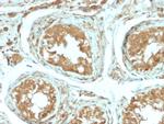 B7-H4 (Immuno-Inhibitory Protein) Antibody in Immunohistochemistry (Paraffin) (IHC (P))