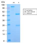 B7-H4 (Immuno-Inhibitory Protein) Antibody in SDS-PAGE (SDS-PAGE)