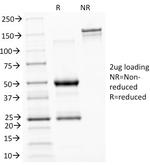 ASRGL1 (Asparaginase Like 1) Antibody in SDS-PAGE (SDS-PAGE)