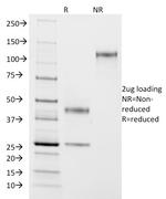 ASRGL1 (Asparaginase Like 1) Antibody in SDS-PAGE (SDS-PAGE)