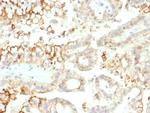 CD276/B7-H3 Antibody in Immunohistochemistry (Paraffin) (IHC (P))