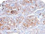 CD276/B7-H3 Antibody in Immunohistochemistry (Paraffin) (IHC (P))