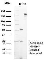 FGF23 (Fibroblast Growth Factor 23) Antibody in SDS-PAGE (SDS-PAGE)