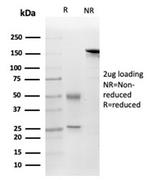 FGF23 (Fibroblast Growth Factor 23) Antibody in SDS-PAGE (SDS-PAGE)