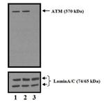 ATM Antibody