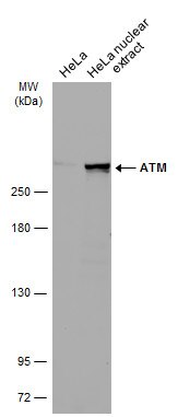 ATM Antibody in Western Blot (WB)