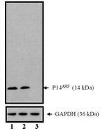 p14ARF Antibody in Western Blot (WB)