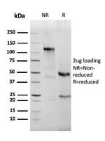 Eosinophil Peroxidase (EPX) Antibody in SDS-PAGE (SDS-PAGE)