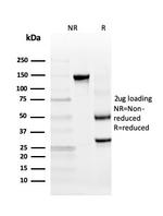 Insulinoma Associated 2/INSM2 Antibody in SDS-PAGE (SDS-PAGE)