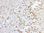 TIM3/HAVCR2/CD366 (Effector T-Cell Marker) Antibody in Immunohistochemistry (Paraffin) (IHC (P))