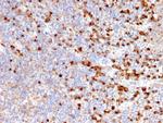 TIM3/HAVCR2/CD366 (Effector T-Cell Marker) Antibody in Immunohistochemistry (Paraffin) (IHC (P))