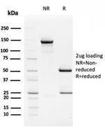 TIM3/HAVCR2/CD366 (Effector T-Cell Marker) Antibody in SDS-PAGE (SDS-PAGE)